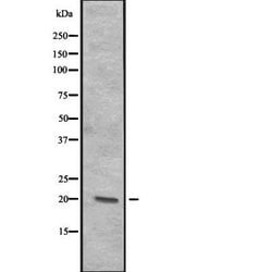 Invitrogen ITGB3BP Polyclonal Antibody 100 &mu;L; Unconjugated:Antibodies,