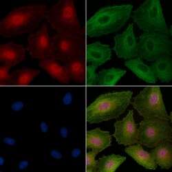 Invitrogen CENPT Polyclonal Antibody 100 &mu;L; Unconjugated:Antibodies,