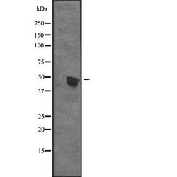 Invitrogen CENPU Polyclonal Antibody 100 &mu;L; Unconjugated:Antibodies,