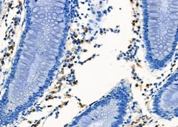 Invitrogen CXCR5 Polyclonal Antibody 100 &mu;L; Unconjugated:Antibodies,