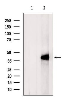 Invitrogen CXCR5 Polyclonal Antibody 100 &mu;L; Unconjugated:Antibodies,