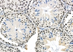 Invitrogen CYLC1 Polyclonal Antibody 100 &mu;L; Unconjugated:Antibodies,