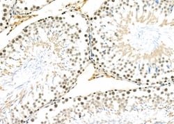 Invitrogen CYLC1 Polyclonal Antibody 100 &mu;L; Unconjugated:Antibodies,