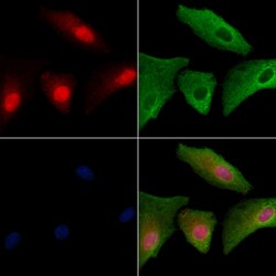 Invitrogen FAM58A Polyclonal Antibody 100 &mu;L | Buy Online | Invitrogen&trade; | Fisher Scientific