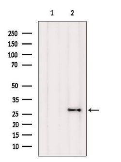 Invitrogen FAM58A Polyclonal Antibody 100 &mu;L | Buy Online | Invitrogen&trade; | Fisher Scientific
