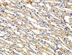 Invitrogen ZPK Polyclonal Antibody 100 &mu;L; Unconjugated:Antibodies,