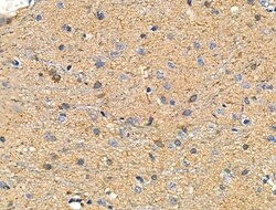 Invitrogen ZPK Polyclonal Antibody 100 &mu;L; Unconjugated:Antibodies,