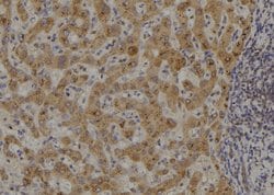 Invitrogen NIK Polyclonal Antibody 100 &mu;L; Unconjugated:Antibodies,