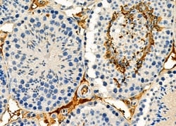 Invitrogen NIK Polyclonal Antibody 100 &mu;L; Unconjugated:Antibodies,