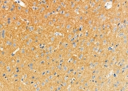 Invitrogen NIK Polyclonal Antibody 100 &mu;L; Unconjugated:Antibodies,