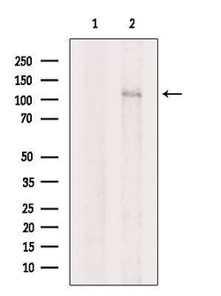 Invitrogen NIK Polyclonal Antibody 100 &mu;L; Unconjugated:Antibodies,