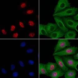 Invitrogen SIVA1 Polyclonal Antibody 100 &mu;L; Unconjugated:Antibodies,