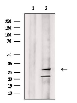 Invitrogen&trade;&nbsp;Granzyme M Polyclonal Antibody