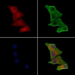 Invitrogen Laminin beta-3 Polyclonal Antibody 100 &mu;L | Buy Online | Invitrogen&trade; | Fisher Scientific