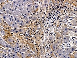 Invitrogen Laminin beta-3 Polyclonal Antibody 100 &mu;L | Buy Online | Invitrogen&trade; | Fisher Scientific