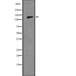 Invitrogen Laminin beta-3 Polyclonal Antibody 100 &mu;L | Buy Online | Invitrogen&trade; | Fisher Scientific