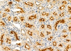 Invitrogen Galectin 10 Polyclonal Antibody 100 &mu;L; Unconjugated:Antibodies,