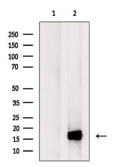 Invitrogen Galectin 10 Polyclonal Antibody 100 &mu;L; Unconjugated:Antibodies,