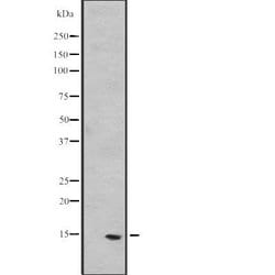Invitrogen PEA15 Polyclonal Antibody 100 &mu;L; Unconjugated:Antibodies,