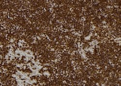 Invitrogen PMS1 Polyclonal Antibody 100 &mu;L; Unconjugated:Antibodies,