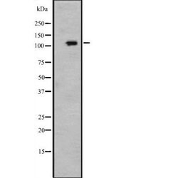 Invitrogen PMS1 Polyclonal Antibody 100 &mu;L; Unconjugated:Antibodies,