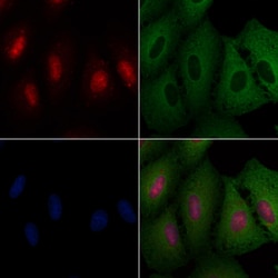 Invitrogen ZNF750 Polyclonal Antibody 100 &mu;L; Unconjugated:Antibodies,