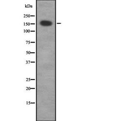 Invitrogen MRCK gamma Polyclonal Antibody 100 &mu;L; Unconjugated:Anticuerpos