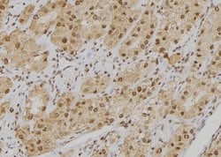 Invitrogen POGZ Polyclonal Antibody 100 &mu;L; Unconjugated:Antibodies,