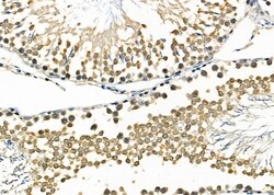 Invitrogen TFAP2D Polyclonal Antibody 100 &mu;L | Buy Online | Invitrogen&trade; | Fisher Scientific