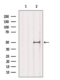 Invitrogen TFAP2D Polyclonal Antibody 100 &mu;L | Buy Online | Invitrogen&trade; | Fisher Scientific