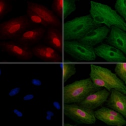 Invitrogen ZSCAN2 Polyclonal Antibody 100 &mu;L; Unconjugated:Antibodies,