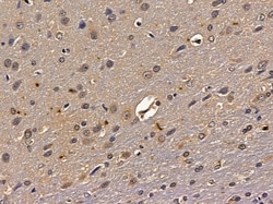 Invitrogen ZSCAN2 Polyclonal Antibody 100 &mu;L; Unconjugated:Antibodies,