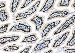 Invitrogen HOMEZ Polyclonal Antibody 100 &mu;L; Unconjugated:Antibodies,