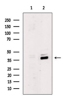 MKX Polyclonal Antibody, Invitrogen 100 &mu;L; Unconjugated:Antibodies,