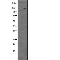 Invitrogen XRN1 Polyclonal Antibody 100 &mu;L | Buy Online | Invitrogen&trade; | Fisher Scientific