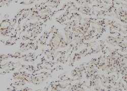 Invitrogen SNAPC3 Polyclonal Antibody 100 &mu;L; Unconjugated:Antibodies,