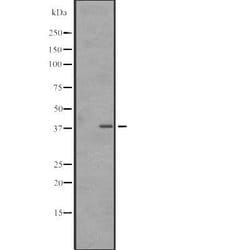 Invitrogen SNAPC3 Polyclonal Antibody 100 &mu;L; Unconjugated:Antibodies,