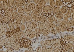 Invitrogen DIRC1 Polyclonal Antibody 100 &mu;L; Unconjugated:Antibodies,
