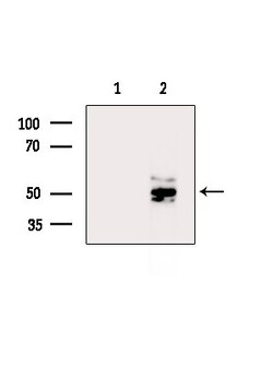 Invitrogen DMRTB1 Polyclonal Antibody 100 &mu;L; Unconjugated:Antibodies,