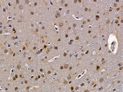 Invitrogen HEXIM2 Polyclonal Antibody 100 &mu;L; Unconjugated:Antibodies,