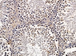 Invitrogen HEXIM2 Polyclonal Antibody 100 &mu;L; Unconjugated:Antibodies,