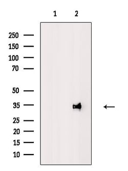 Invitrogen ALKBH3 Polyclonal Antibody 100 &mu;L; Unconjugated:Antibodies,