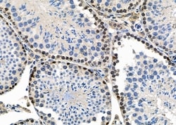 Invitrogen EBNA1BP2 Polyclonal Antibody 100 &mu;L; Unconjugated:Antibodies,