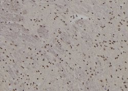 BACH2 Polyclonal Antibody:Antibodies, Polyclonal