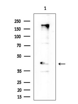 BACH2 Polyclonal Antibody:Antibodies, Polyclonal
