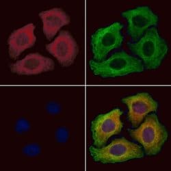 Invitrogen TRIM31 Polyclonal Antibody 100 &mu;L; Unconjugated:Antibodies,