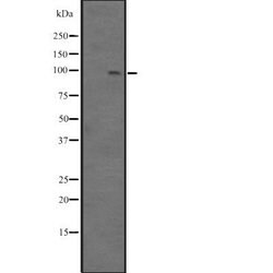 Invitrogen BCL11B Polyclonal Antibody 100 &mu;L; Unconjugated:Antibodies,