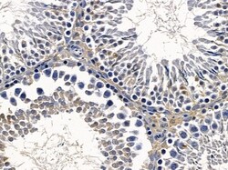 Invitrogen MOB1 Polyclonal Antibody 100 &mu;L; Unconjugated:Antibodies,