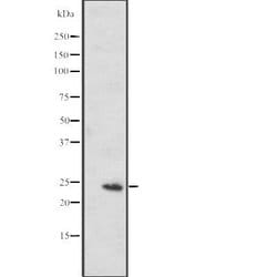 Invitrogen MED20 Polyclonal Antibody 100 &mu;L; Unconjugated:Antibodies,