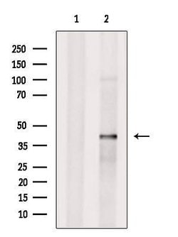 Invitrogen SLC35C2 Polyclonal Antibody 100 &mu;L; Unconjugated:Anticuerpos